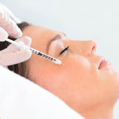 ¿Qué es la mesoterapia facial? preguntas frecuentes